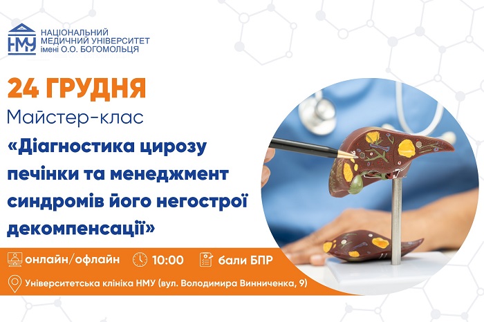 У НМУ відбудеться майстер-клас з діагностики та менеджменту цирозу печінки для лікарів