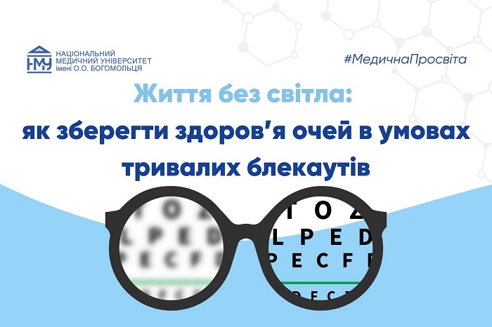 Життя без світла: як зберегти здоров’я очей в умовах тривалих блекаутів