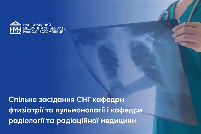 Гуртківці вивчали методи діагностики туберкульозу