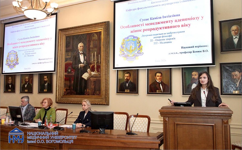 Аспірантка визначила особливості менеджменту аденоміозу у жінок репродуктивного віку