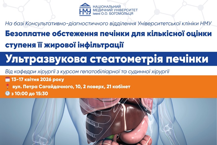 13-17 квітня в Університетській клініці НМУ можна безкоштовно обстежити печінку
