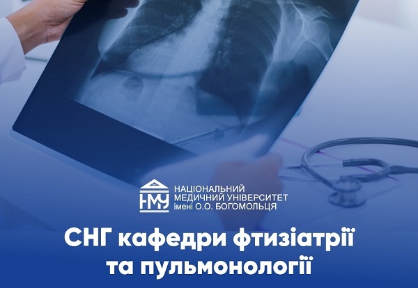 Наслідки іонізуючого випромінювання вивчали на засіданні СНГ