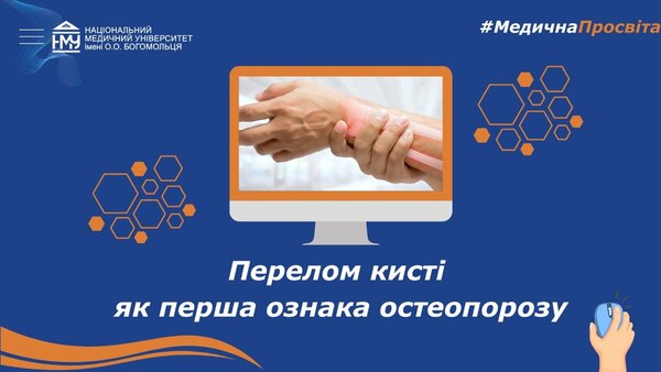 #Медична просвіта: Перелом кисті як перша ознака остеопорозу
